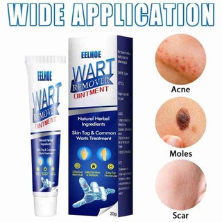 Kem loại bỏ mụn cóc mụn cóc