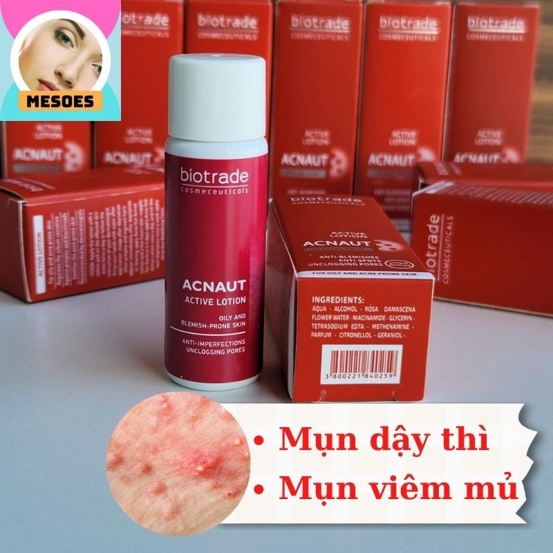 Dung Dịch Chấm Mụn Biotrade Acnaut Active Lotion - Giảm Mụn Viêm, Kiểm Soát Dầu, Ngừa Mụn Đầu Đen
