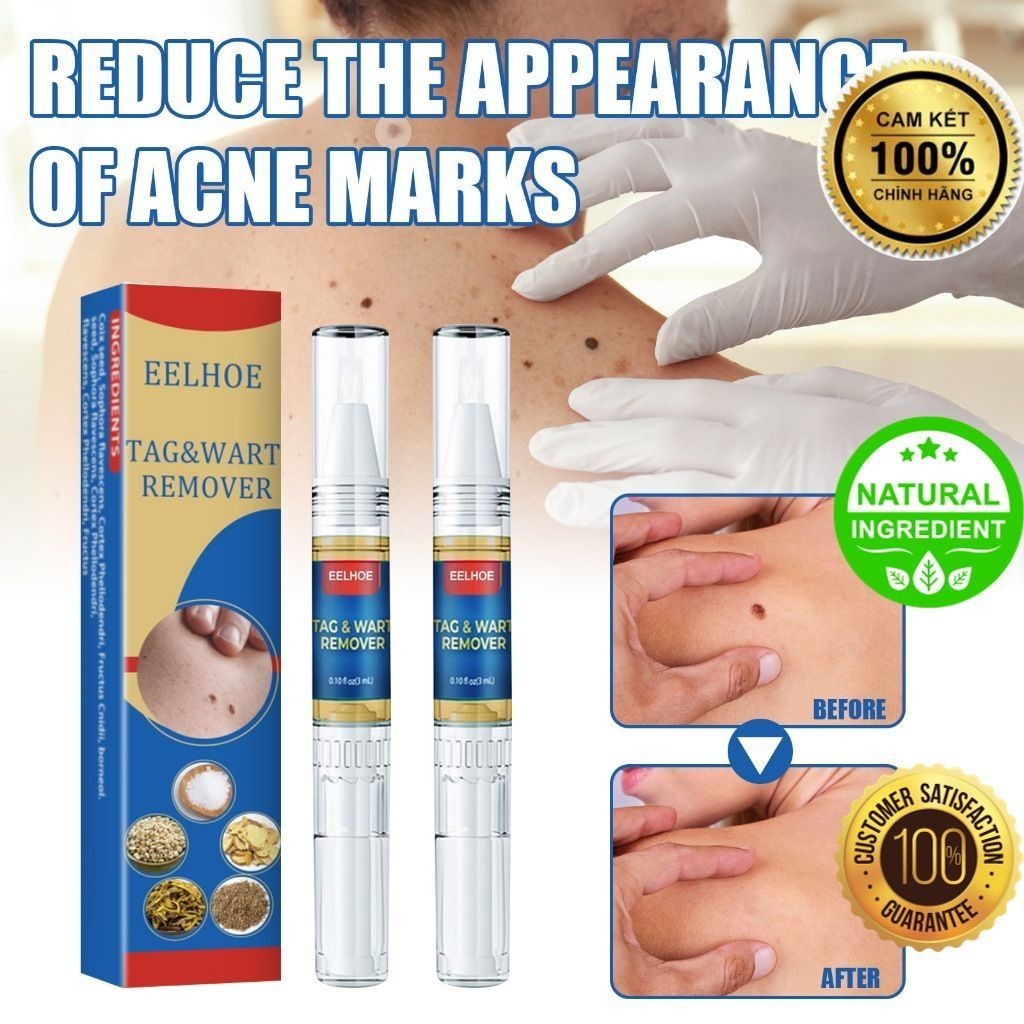 Bút EELHOE Chấm Mụn Thịt, Nốt Ruồi, Mụn Cóc, Mụn Thịt Thừa, cam kết an toàn và hiệu quả  [Herbal Mall]