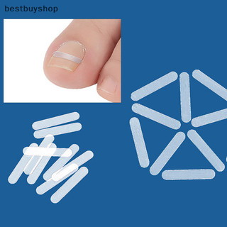 Cửa hàng tốt nhất 10 chiếc ingrown ngón chân điều trị móng chân ingrown công cụ chỉnh sửa đàn hồi miếng dán thẳng kẹp nẹp dụng cụ làm móng chân mới