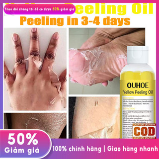 Dầu Lột Vàng Da Lột Cơ Thể Nách Dầu Lột Làm Trắng Da Tẩy Tế Bào Chết Loại Bỏ Da Chết