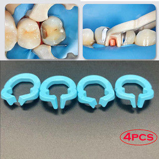 4 hệ thống ma trận nha khoa nhựa nha khoa kẹp và tách vòng cao su đập nha sĩ dụng cụ