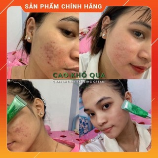 Cao Khổ Qua Dành Cho Da Mụn soHERBs 10ml
