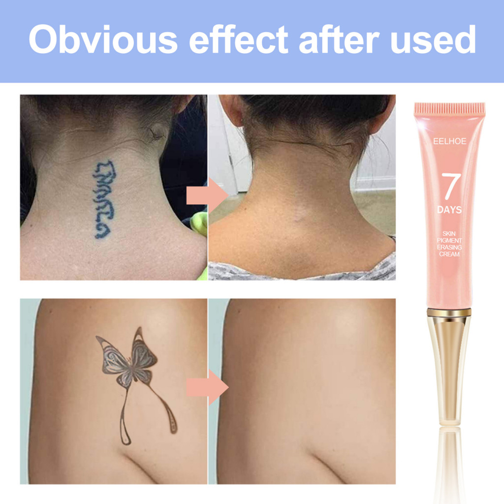 13g Kem Xóa Hình Xăm Không Đau Tác Dụng Nhanh Thành Phần An Toàn Không Sẹo Hình Xăm Làm Sạch Trang Trí Cho Unisex