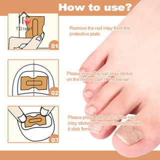   Tdiepf  60 Miếng dán chỉnh sửa móng tay mọc ngược Miếng dán chỉnh sửa móng chân Paronychia Treatment Recover Corrector Dụng cụ chăm sóc móng chân MỚI 