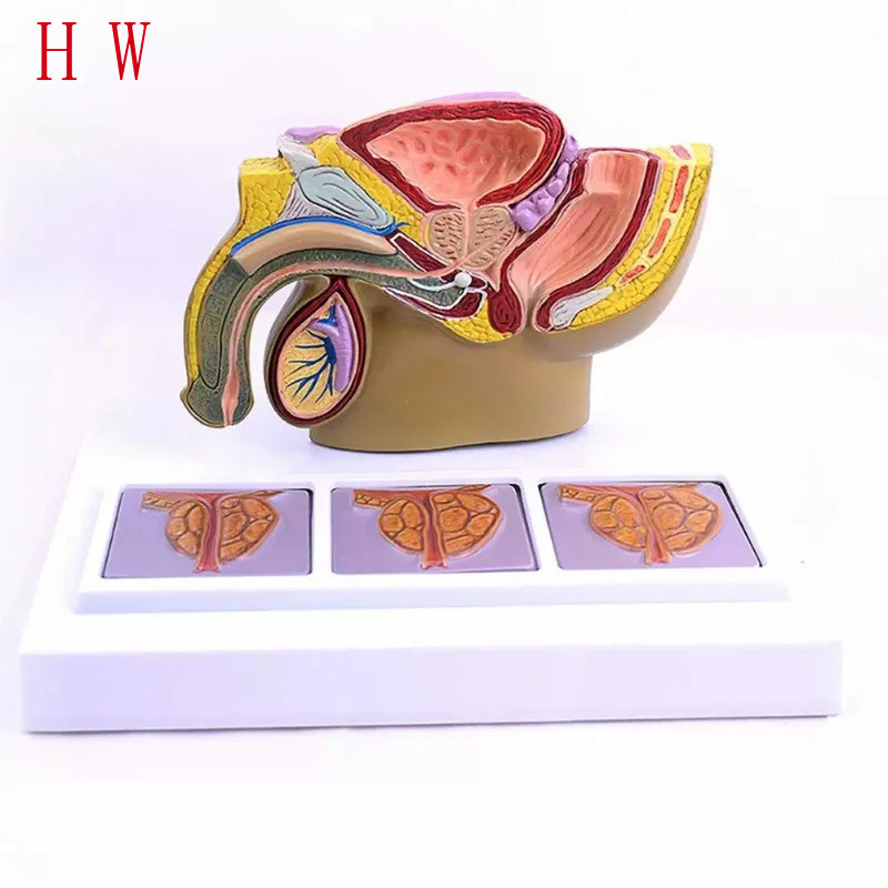 Con người Nam Pelvis Bệnh lý tuyến tiền liệt Phần Mô hình Trường Y%