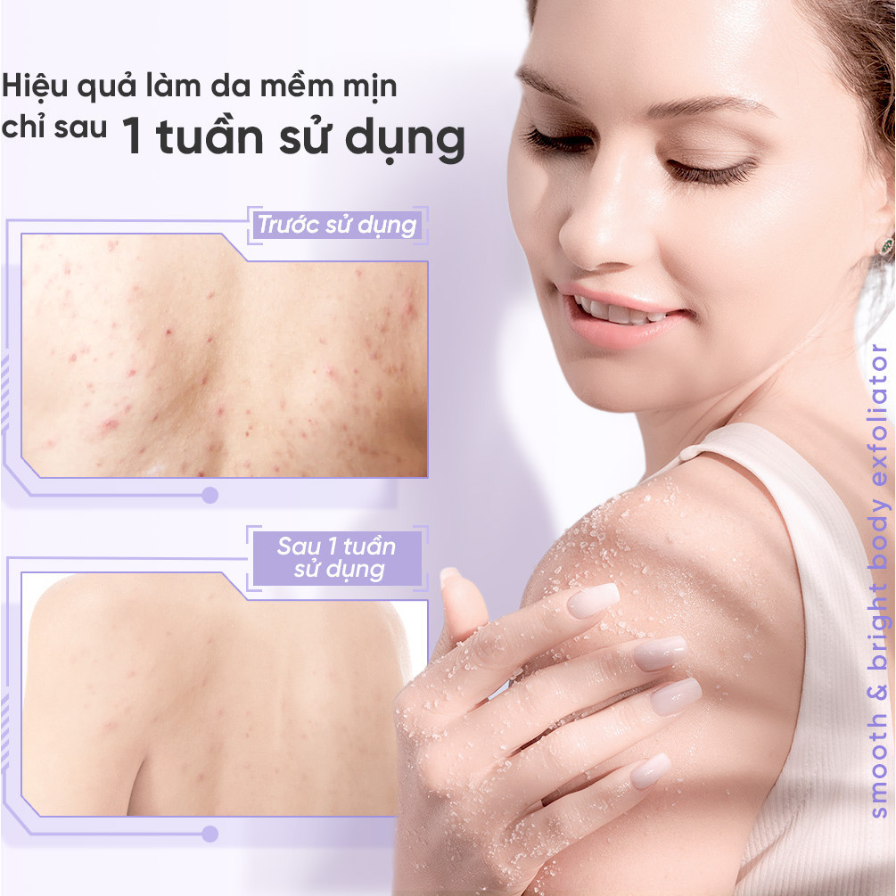 Ảnh 5 của Tẩy Tế Bào Chết Làm Sáng Da Toàn Thân Emmié by HappySkin Smooth & Bright Body Exfoliator 200g