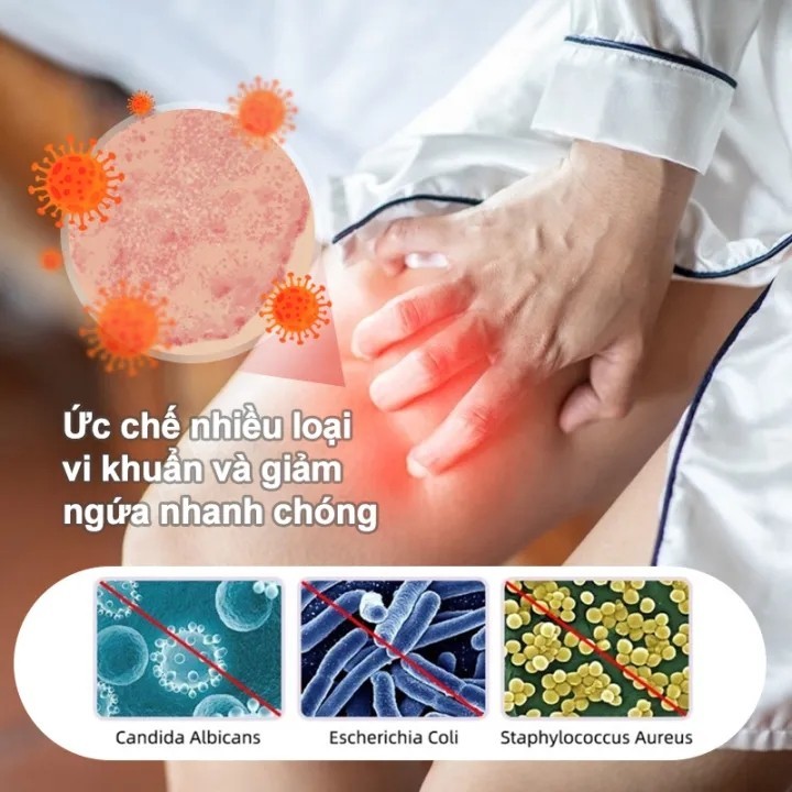 Kem giảm ngứa Kem bôi nấm ngứa Chăm sóc vùng kín Chống ngứa nhanh 20g Giảm nhẹ ngứa da Bên trong đùi Hậu môn Chàm Mông