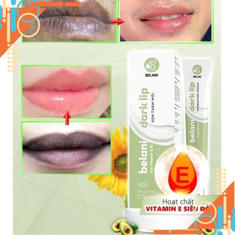 sg 11134201 7rcen lt1c9eunmrc172