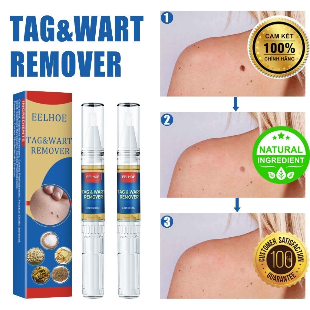 Bút EELHOE Chấm Mụn Thịt, Nốt Ruồi, Mụn Cóc, Mụn Thịt Thừa, cam kết an toàn và hiệu quả  [Herbal Mall]