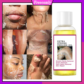 Dầu lột da cho da thâm, Dầu lột vàng với Salicylic Natri Hyaluronate, Dầu lột mạnh Thêm sức mạnh, Giải pháp lột da tẩy tế bào chết cho cơ thể mọi loại da