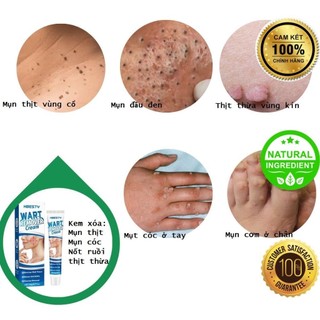 Kem Bôi Mụn Quanh Mắt, Mụn Cổ, Mụn Cóc, Nốt Ruồi, Tàn Nhang, Giá Siêu Rẻ_HBESTY Herbal Cream 