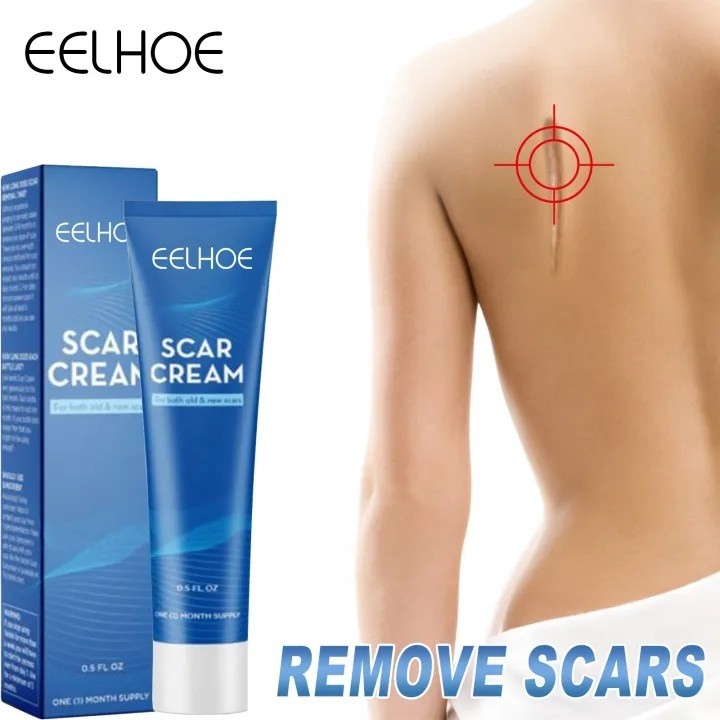 Kem xóa sẹo, loại bỏ hiệu quả các vết sẹo lâu năm, sẹo phẫu thuật, phục hồi và làm sáng các vết rạn da khi mang thai