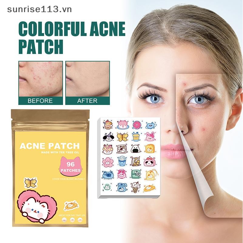 SR Beauty 96 Miếng Dán Mụn Hình Hoạt Hình Điều Hỗ trợ giảm mụn Miếng Dán Vô Hình Mụn Loại Bỏ Mụn Miế