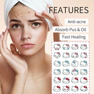 24 chiếc Hello Kitty Acne Patch Tea Tree Acne Patch Hydrocoloid Acne Covering Patch