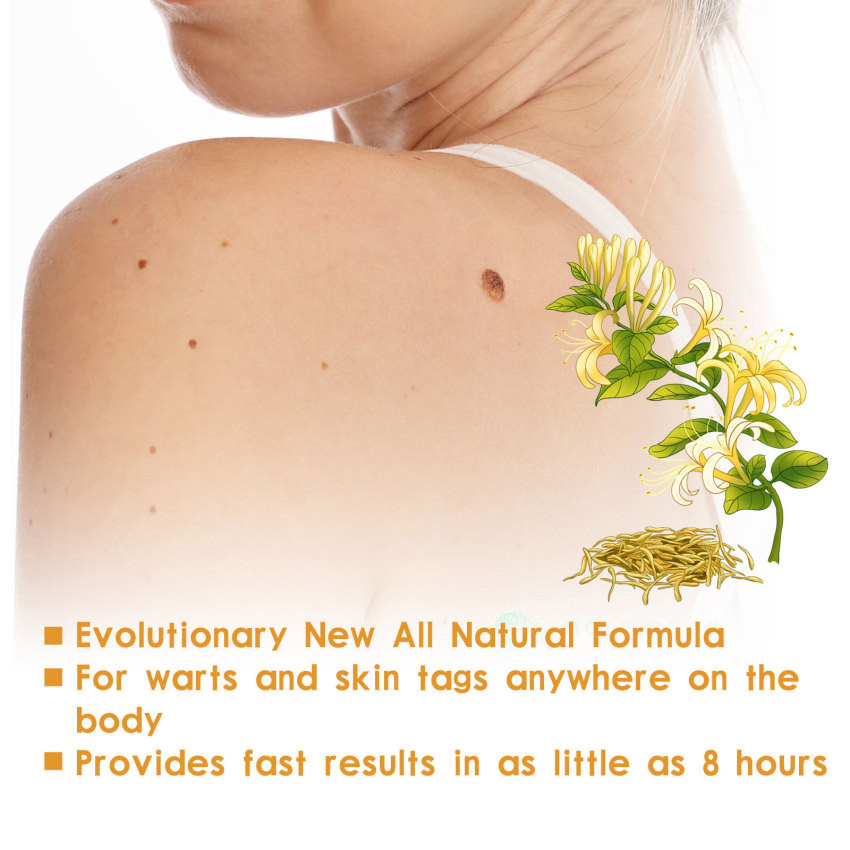 Tinh chất giảm mụn cóc và ngô làm sạch sâu | BigBuy360 - bigbuy360.vn