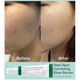 Axis-y Dark Spot Correcting Glow Serum 5ml / 50ml