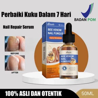  Tinh chất  Nấm Móng Tay Chân Hết Sạch Nấm Bọng Móng Hư Khoé Nước Ăn Tay Chân Dưỡng Cứng Móng 