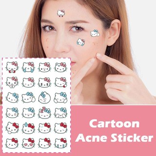 Sanlio Mụn Miếng Dán Mụn Cho Chó Lớn Mụn Miếng Dán Hydrocoloid Acne Chứa Chăm Sóc Da Cây Trà O4F6