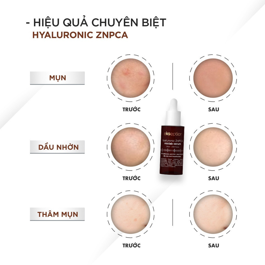 Tinh Chất Serum Kẽm Dưỡng Ẩm Sâu, Giảm Mụn, Ekseption Hyaluronic ZnPCA/Niacin/TRX/PHA/B5/Retin-oil Mixlab Serum 75ml