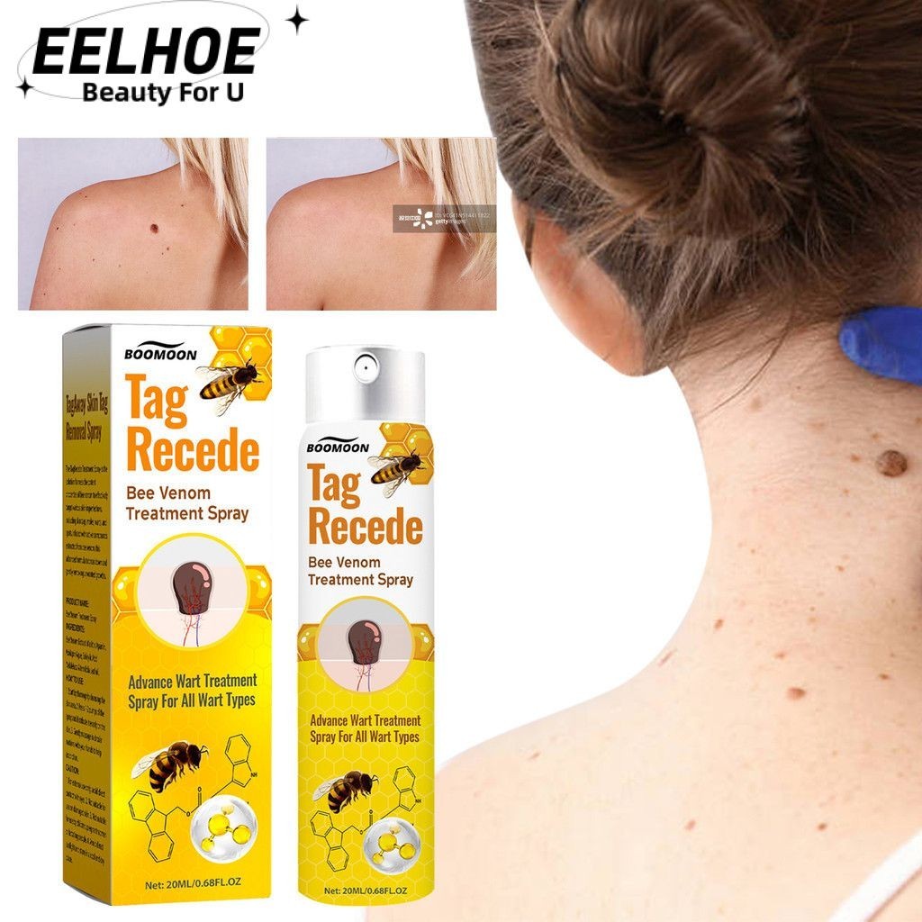 Boomoon Ong Nọc Độc Loại Bỏ Mụn cóc Điều Trị Xịt Ong Nọc Độc Xịt Mụn cóc Tẩy Nốt Ruồi Thẻ Da Loại Bỏ Hạt