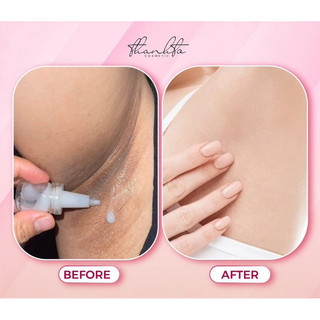 Serum giảm thâm Jiuhe Bye-Bye Melano 5ml
