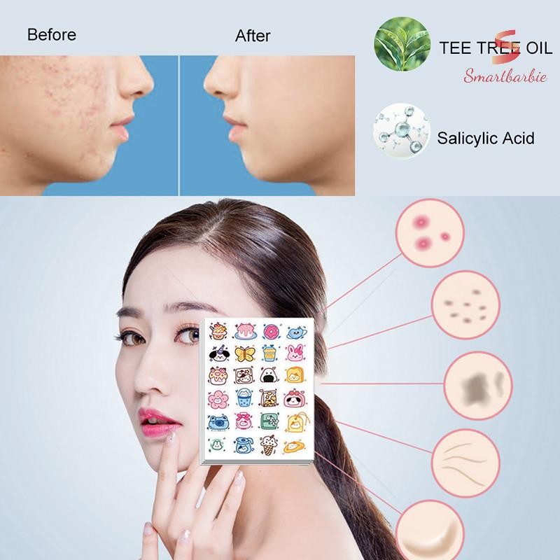 {Smartbarbie} 96 Miếng Dán Mụn Hình Hoạt Hình Điều Hỗ trợ giảm mụn Miếng Dán Vô Hình Mụn Loại Bỏ Mụn