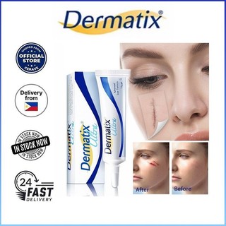 ⚡⚡COD Dermatix Ultra Gel 15g Công thức loại bỏ sẹo nâng cao Sửa chữa Chăm sóc da Điều trị mụn Loại bỏ vết rạn da Kem dưỡng trắng da Ultra Scar Remover Scar Gel