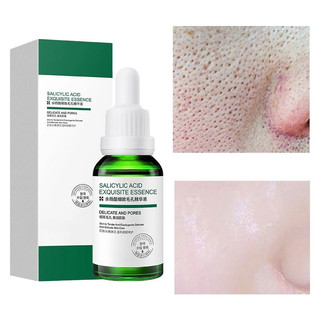 Tinh chất se khít lỗ chân lông VENZEN axit salicylic dưỡng ẩm làm trắng và săn chắc da chống mụn 30ml