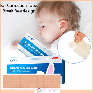 [Chamer] 10 / 20 / 30 Cái Dụng Cụ Chỉnh Tai Cho Bé Băng Silicon Chỉnh Tai Trẻ Sơ Sinh MỚI