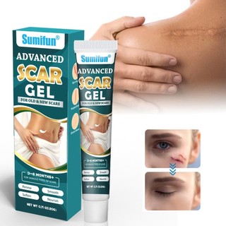 Kem loại bỏ sẹo 20g burn repair scar cream dụng cụ sửa chữa da kem scar away giảm sự xuất hiện của vết sẹo mới banivn