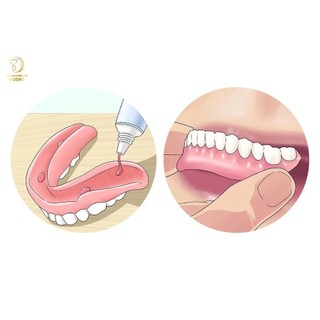 Keo Dán Răng Fixodent (USA) | Dán Hàm Giả