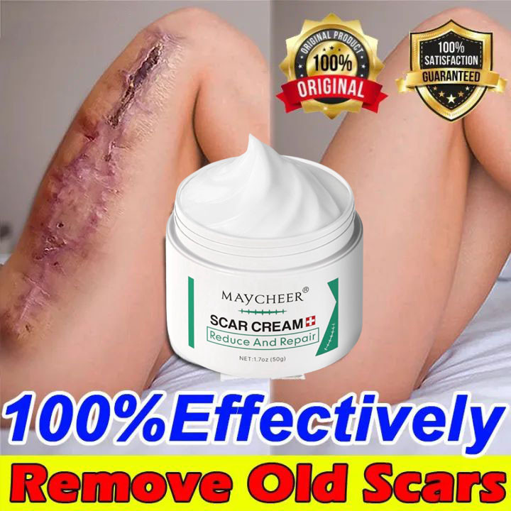Kem Sẹo MAYCHEER Kem Xoá Sẹo Hỗ Trợ Xóa Mờ Sẹo Lồi, Lõm, Bỏng Bô, Thủy Đậu hiệu quả /Kem bôi muỗi đốt