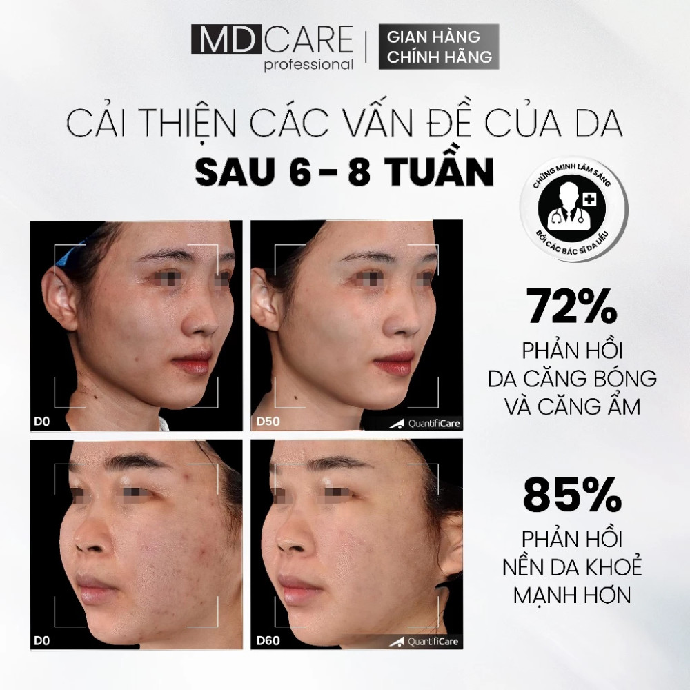 Ảnh 8 của Tẩy Tế Bào Chết Làm Sáng, Mờ Thâm, Đều Màu Và Da Kiểm Soát Mụn MD Care 10ml, 30ml