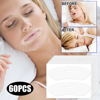 30 / 60 Miếng dán thở chống ngáy - Miếng dán thở khi ngủ ban đêm - Băng hỗ trợ giấc ngủ điều chỉnh miệng - Băng bịt miệng - Miếng dán kín giấc ngủ cải thiện