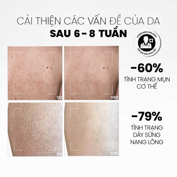 Ảnh 4 của Sữa Tắm MD CARE  AHAs and BHA Exfoliating Body Wash Giảm Mụn và Tẩy Tế Bào Chết 200ml