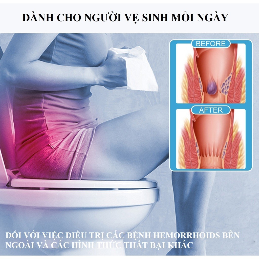 Kem Thoa Trĩ Đa Năng KanyeHB Giảm Tình Trạng Ngứa - Sưng - Đau - Rát - Chảy Máu Vùng Hậu Môn