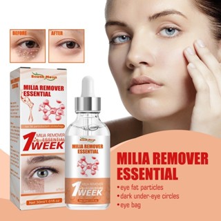  Milia Remover Essential Eye Serum Loại bỏ hiệu quả Hạt mỡ Túi mắt Chống mụn bọng mắt Cải thiện quầng thâm 