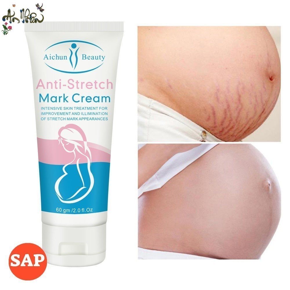 Kem làm mờ rạn da, kem tái tạo da hiệu quả cho bà bầu Anti-stretch Marks Cream - mờ sẹo, giảm thâm, giảm nhăn hiệu quả