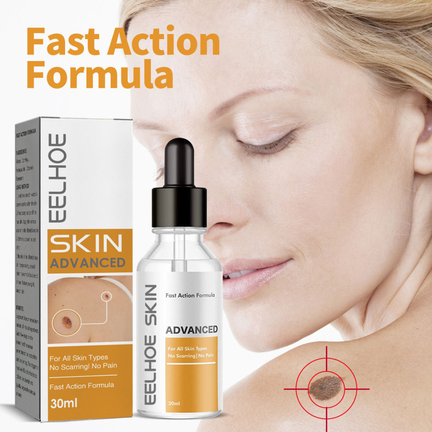 Tinh chất giảm mụn cóc và ngô làm sạch sâu | BigBuy360 - bigbuy360.vn