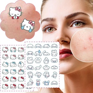 Sanlio Acne Patch Big-Eared Dog Acne Sticker Hydrocoloid Chứa Trà Tree Acne Sticker Chăm sóc da