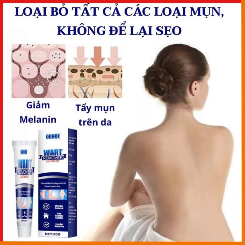 Kem thoa mụn Wart remover - HTstore