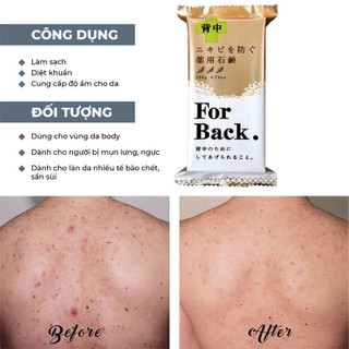 Xà phòng tắm ngừa mụn lưng For Back Pelican 135g Nhật Bản