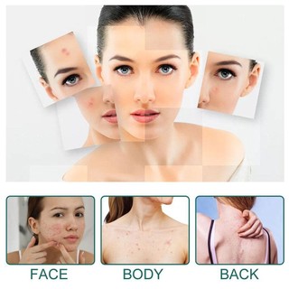 24 chiếc Hello Kitty Acne Patch Tea Tree Acne Patch Hydrocoloid Acne Covering Patch