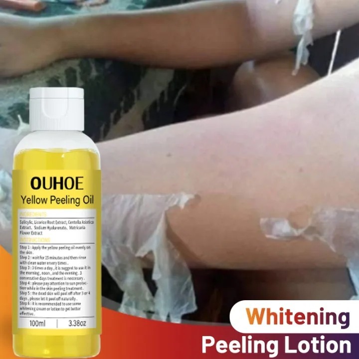 PEEL DA MẶT CAO CẤP - tẩy da chết - giảm mụn mờ nám tàn nhang - thay da sinh học peel lột da mặt