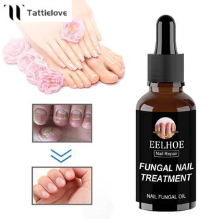 Tinh chất giảm nấm móng JULYSTAR Paronychia 50ml