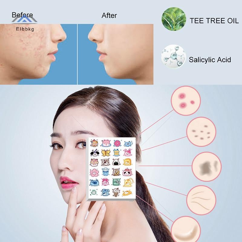 ELBBKG 96 Miếng Dán Mụn Hình Hoạt Hình Giảm Mụn Hỗ Trợ Vô Hình Miếng Dán Mụn Loại Bỏ Mụn Mới Chăm Só