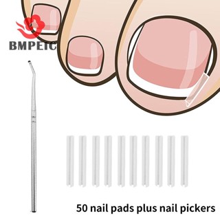 Bmpeic 50 Cái Dụng cụ chỉnh sửa móng chân mọc ngược Ngón chân Điều trị móng tay Miếng dán đàn hồi Miếng dán thẳng Kẹp Nẹp Dụng cụ làm móng chân mới 
