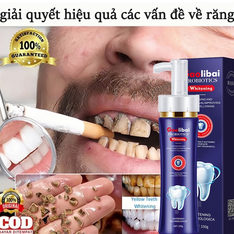 Kem đánh răng kem đánh răng cận cảnh kem đánh răng làm trắng răng làm trắng răng kem đánh răng làm t