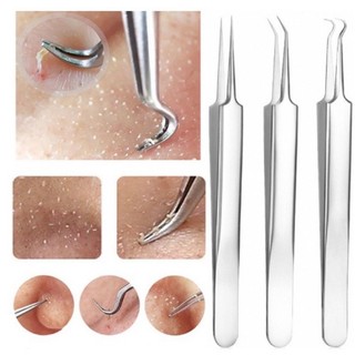  Bộ 3 Cây Gắp Nặn Mụn Đầu Đen Mụn Trứng Cá Chất Liệu Thép Không Gỉ Dài 8cm An Toàn Tiện Dụng 